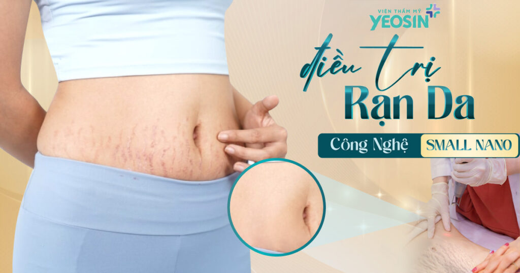 BANNER-BLOG-Dieu-tri-ran-da-bang-cong-nghe-Small-Nano-F-1