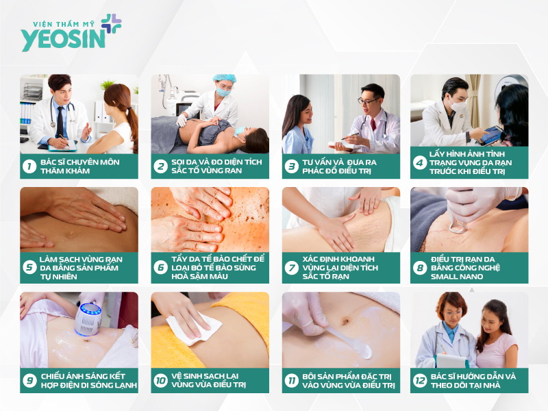 Quy-trình-trị-rạn-da