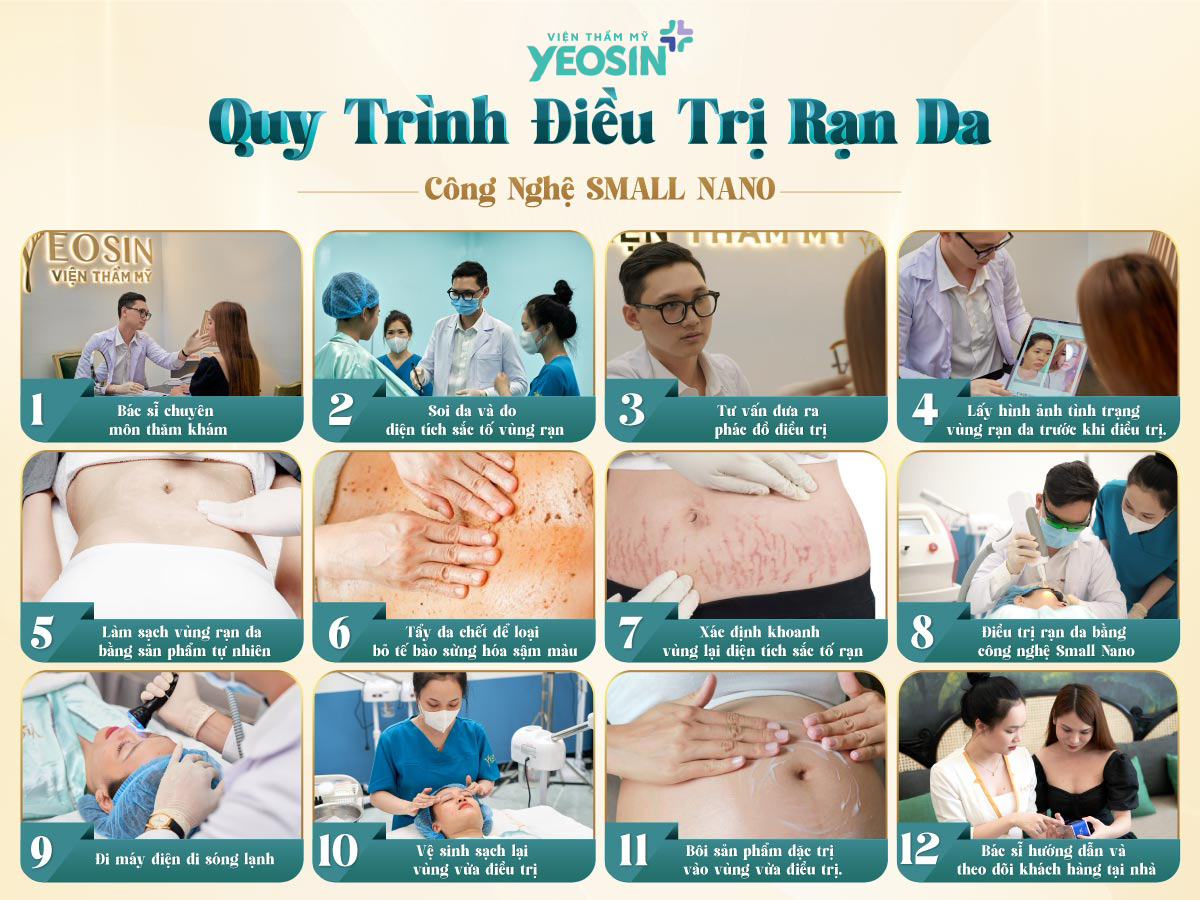 hinh anh Quy trinh dieu tri ran da bang cong nghe Small Nano 1