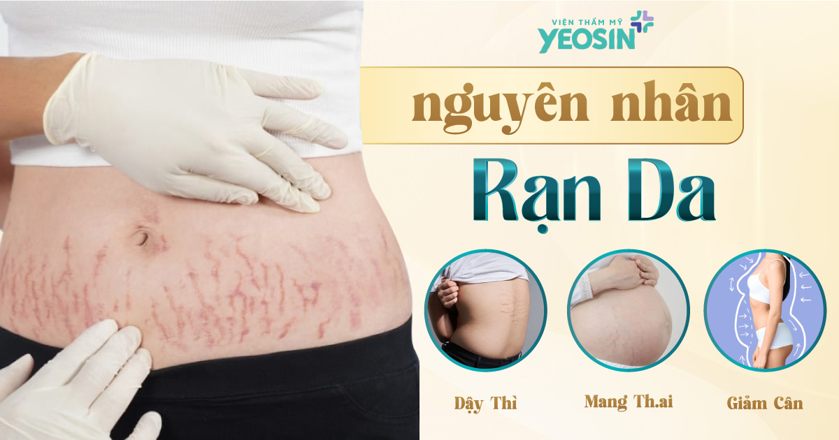 hinh anh Ran da la gi Nguyen nhan gay ran da 1