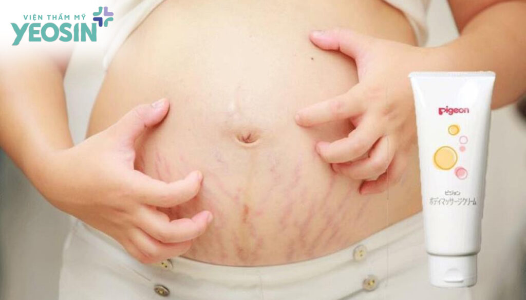 ran-da-khi-mang-thai-3