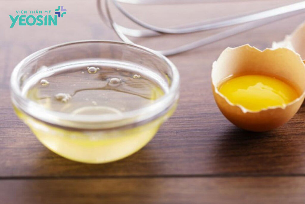 Top 5 cách trị rạn da sau sinh an toàn và hiệu quả 7 tri-ran-da-sau-sinh-2
