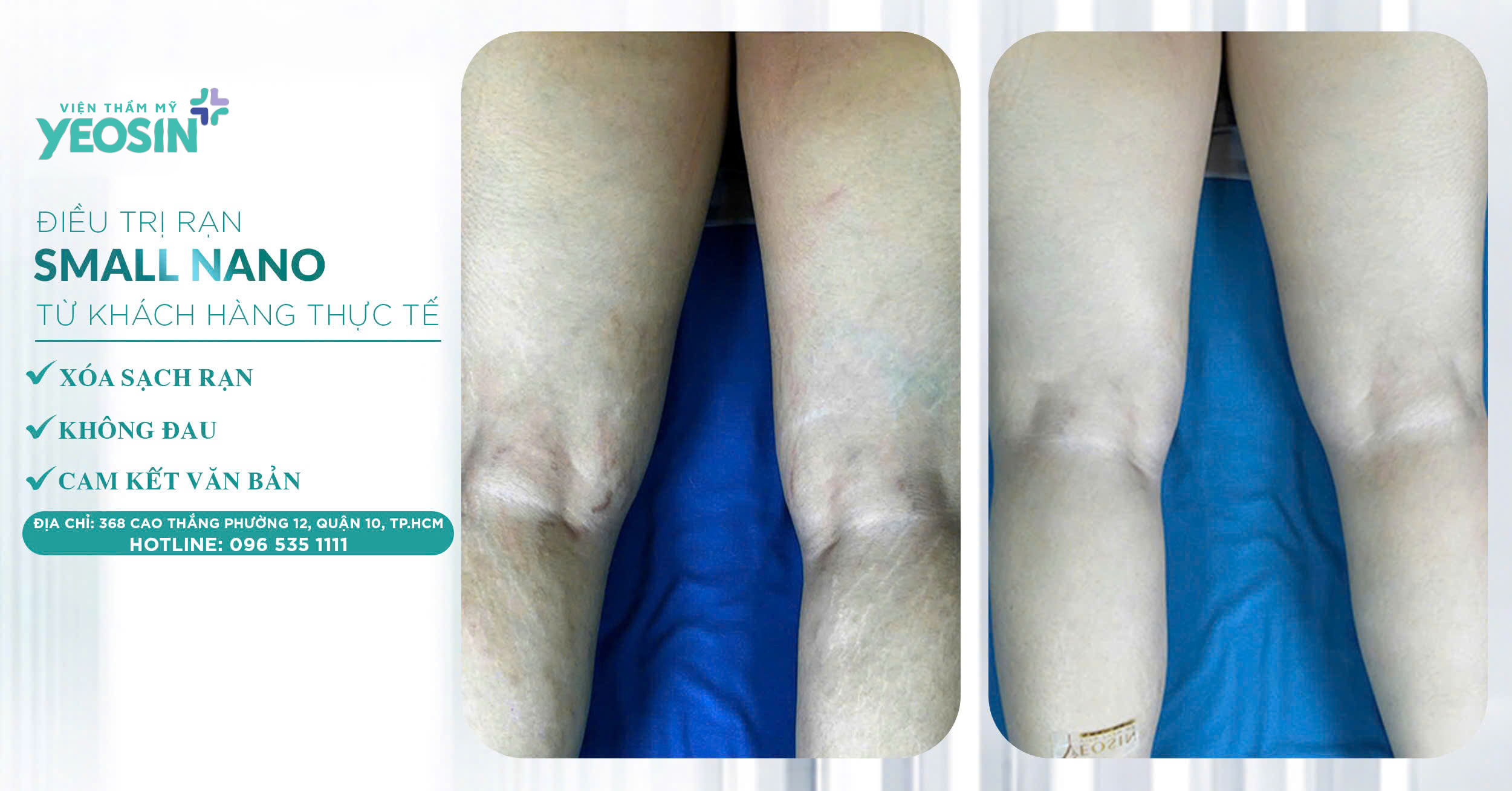 z6523936952330 cbcca1a21bd92cc9087d599f826662fd 1