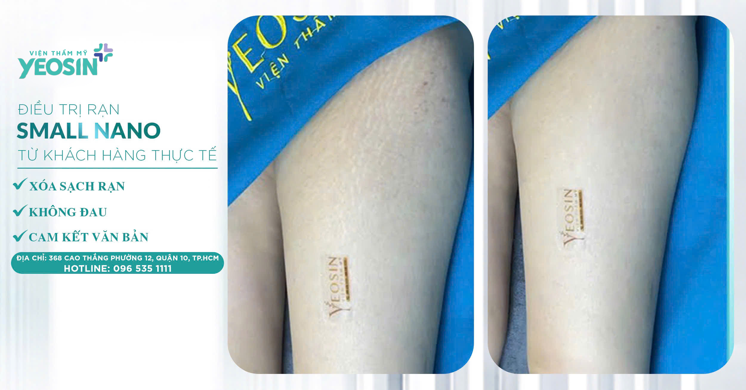 z6523936964244 c2152b3f4b83f88ef1a7ce9994f990e1 1