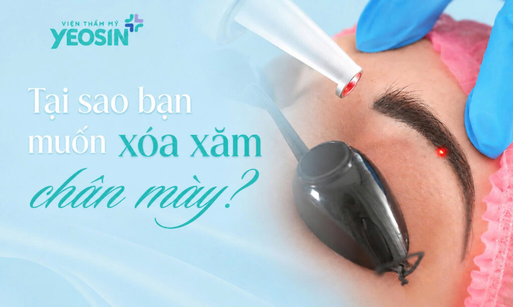 Tại sao bạn muốn xóa xăm chân mày?