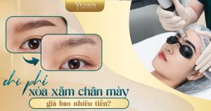 BANNER BIA CHI PHI XOA XAM CHAN MAY BAO NHIEU TIEN