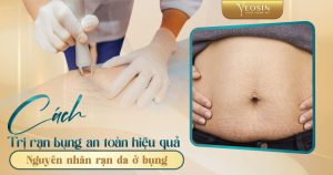 BANNER BLOG BIA RAN DA BUNG