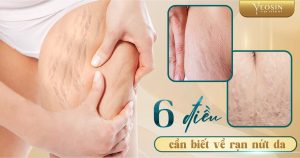 BANNER BLOG RAN DA 02 1