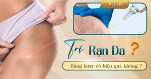 BANNER BLOG RAN DA 03