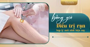 BANNER BLOG RAN DA 04