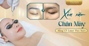 BANNER BLOG XOA XAM CHAN MAY BANG CN LASE PICO SURE