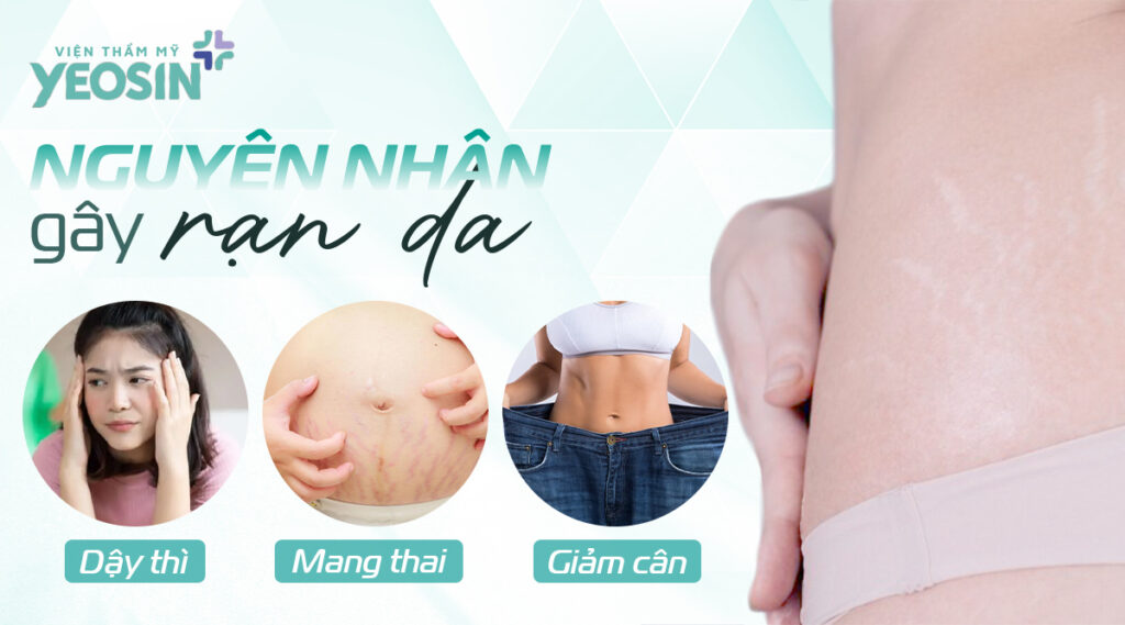 Nguyên nhân gây rạn da
