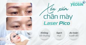 BANNER-BLOG-XOA-XAM-CHAN-MAY-BANG-CN-LASE-PICO-SURE