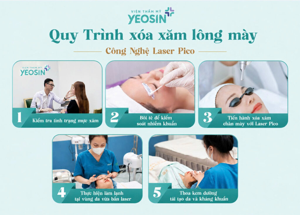 Quy trình xóa xăm lông mày bằng Laser Pico tại Phòng Khám Thẩm Mỹ Yeosin