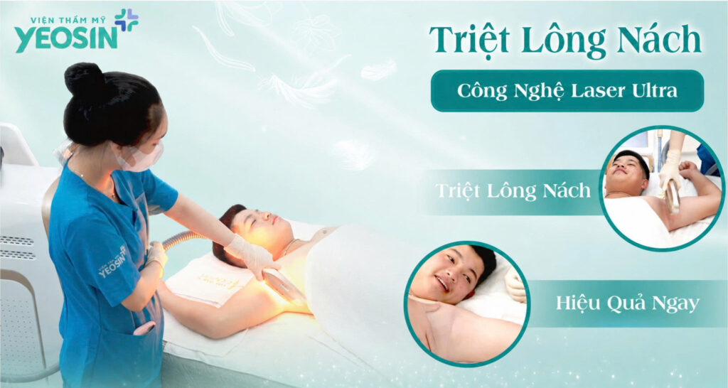 Địa chỉ triệt lông nách uy tín nhất tại Tphcm