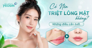 banner-co-nen-triet-long-mat-nu