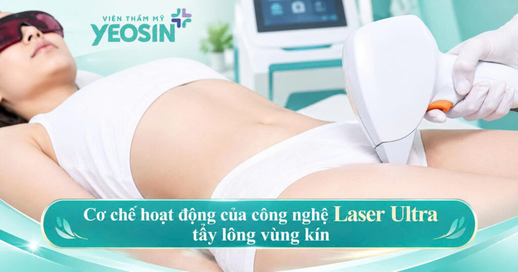 Cơ chế hoạt động của công nghệ Laser Ultra tẩy lông vùng kín