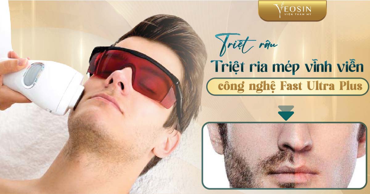 Triệt râu, triệt ria mép vĩnh viễn bằng CN Fast Ultra Plus
