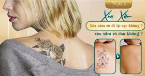 BANNER BLOG XOA XAM TT 02