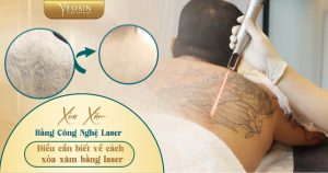 BANNER BLOG XOA XAM TT 07