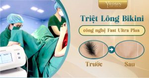 BANNER BLOG XOA XAM TT 13