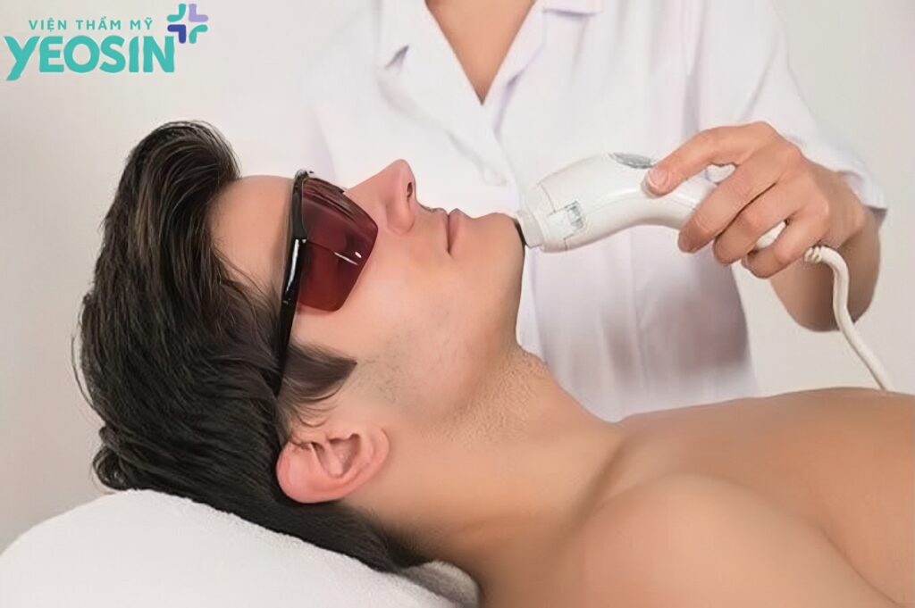 Cơ chế hoạt động của công nghệ triệt râu Laser Ultra