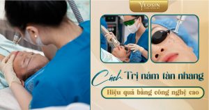 BANNER BLOG TRI NAM YEOSIN 1 08