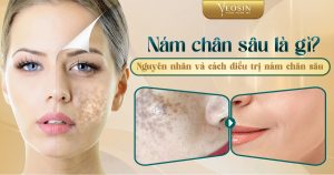BANNER BLOG TRI NAM YEOSIN 2 02