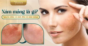 BANNER BLOG TRI NAM YEOSIN 2 04