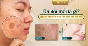 BANNER BLOG TRI NAM YEOSIN 2 06