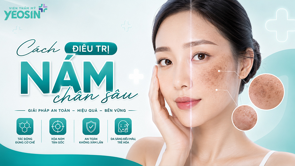 Nguyên nhân và cách điều trị nám chân sâu