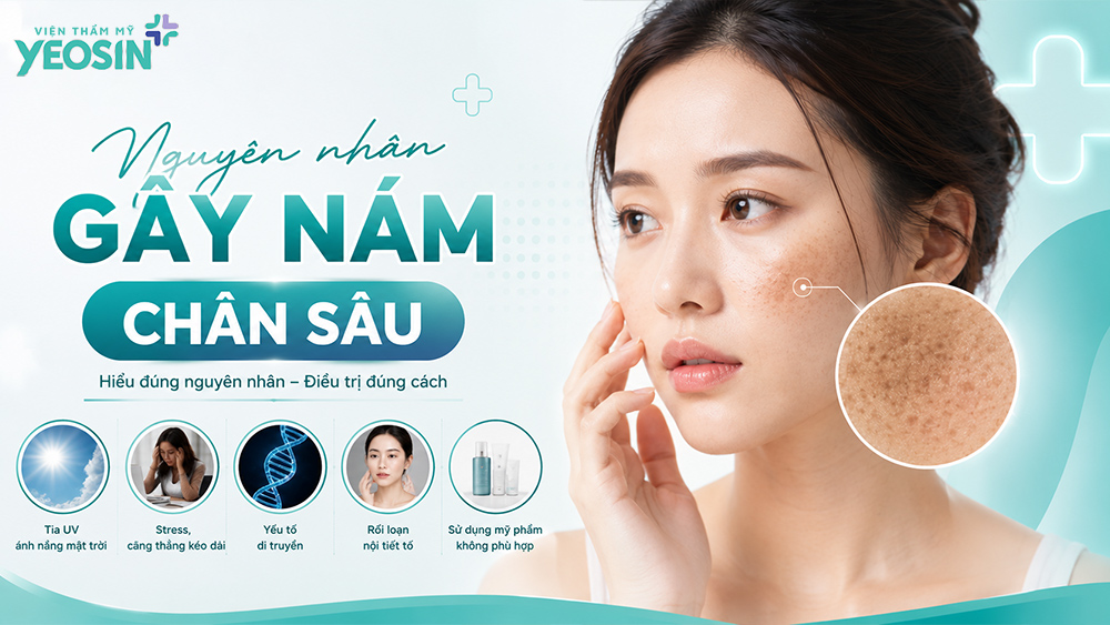 Những nguyên nhân gây nám chân sâu thường gặp