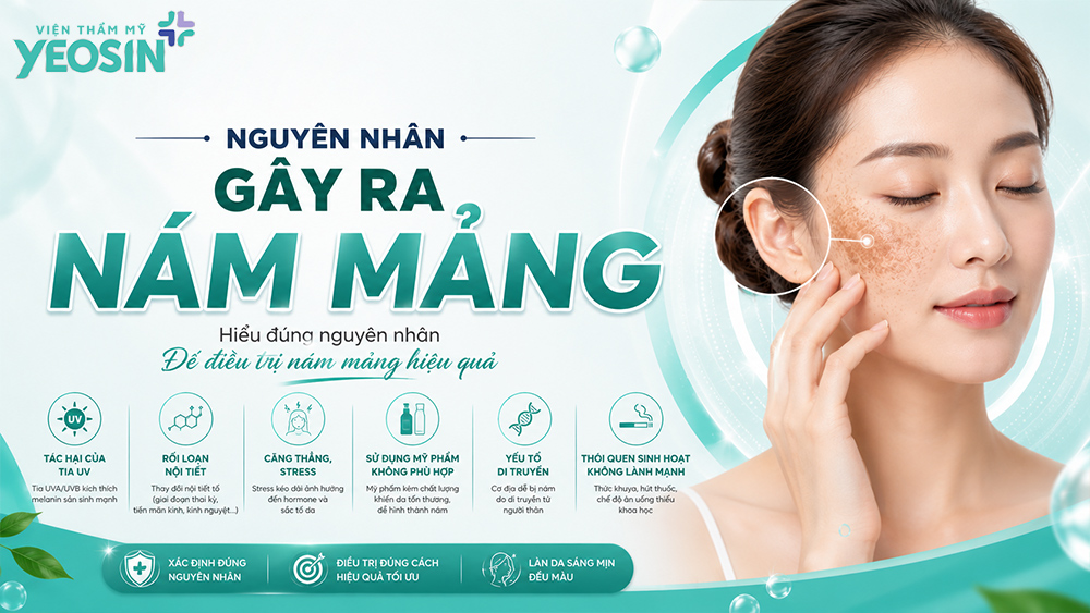 Nguyên nhân bị nám mảng là gì?