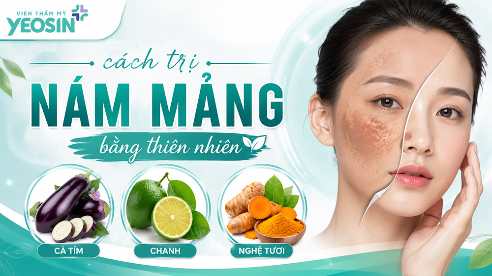 Cách điều trị nám mảng bằng phương pháp tự nhiên