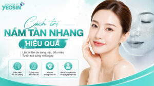 Cách trị nám tàn nhang hiệu quả