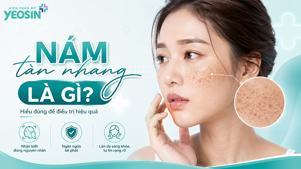 Nám tàn nhang là gì? Cách trị nám tàn nhang hiệu quả 5 Nám tàn nhang là gì?