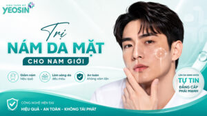 Nám da ở nam giới: Nguyên nhân và cách trị nám da mặt cho nam giới
