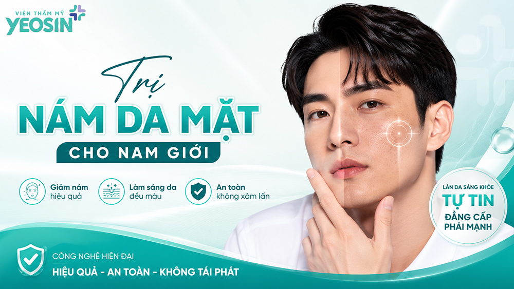 Nám da ở nam giới: Nguyên nhân và cách trị nám da mặt cho nam giới