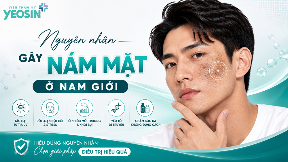 Nguyên nhân gây nám mặt ở nam giới là gì?