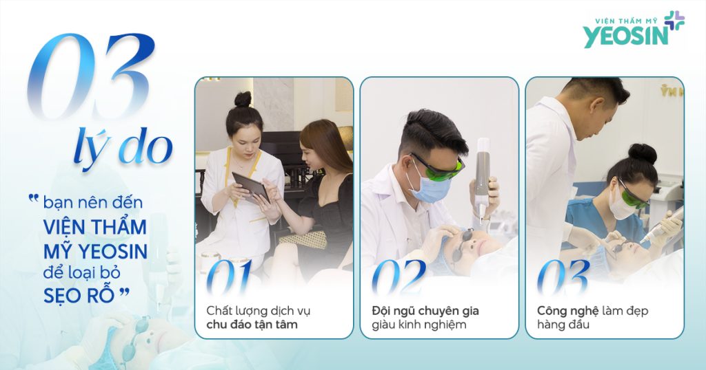Lý do bạn nên đến Viện Thẩm Mỹ Yeosin để điều trị sẹo rỗ.