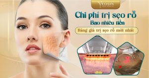 BANNER BLOG DIEU TRI SEO RO 12