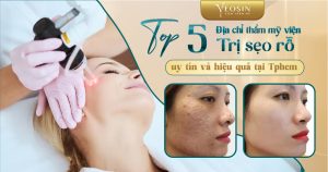 BANNER BLOG DIEU TRI SEO RO 16