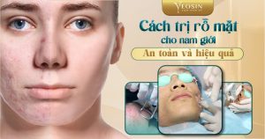 BANNER BLOG DIEU TRI SEO RO 17