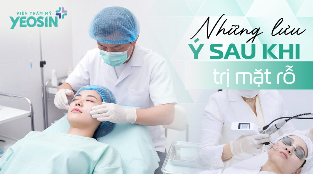 Những lưu ý sau khi trị mặt rỗ bạn cần biết