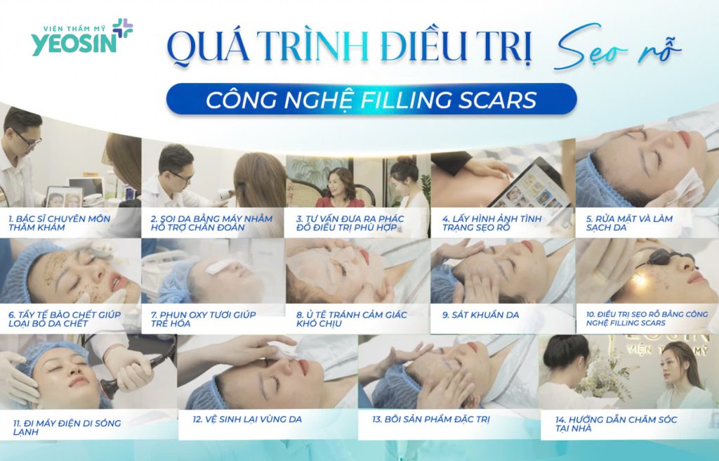 Quy trình điều trị sẹo rỗ bằng công nghệ Filling Scars.