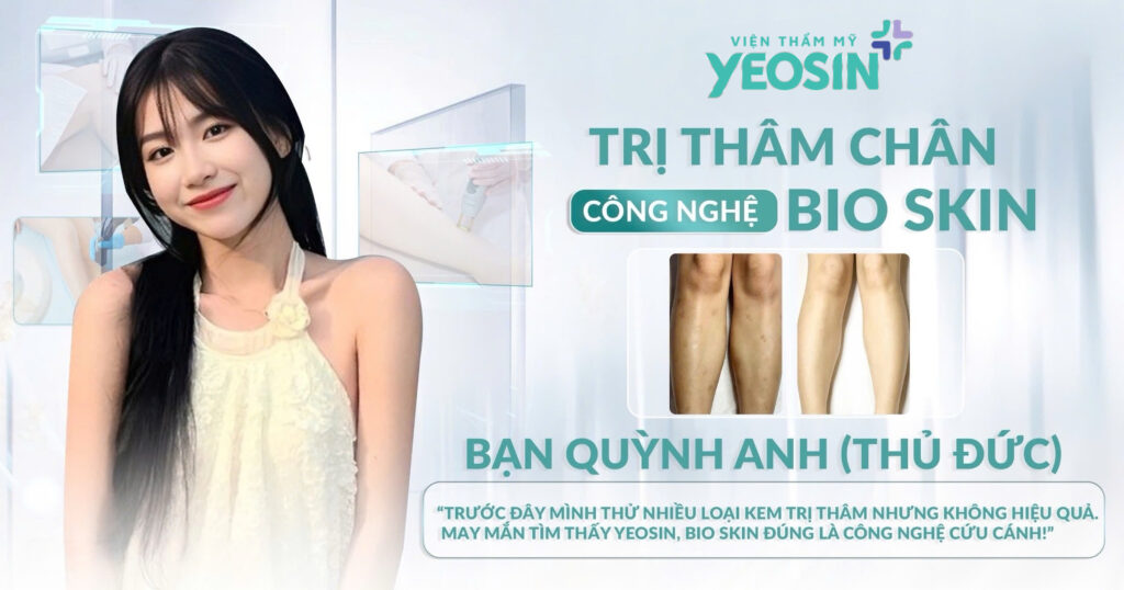 TRI-THAM-CHAN-YEOSIN