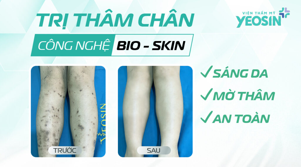 tri tham chan bang cong nghe bio skin 3