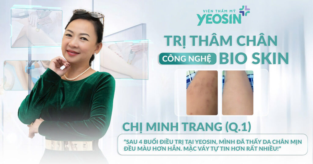 TRI-THAM-CHAN-YEOSIN