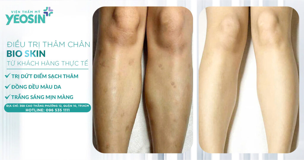 TRI-THAM-CHAN-YEOSIN