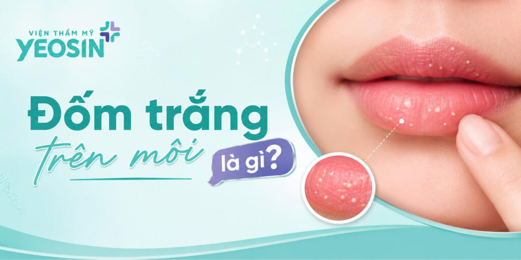 Đốm trắng trên môi: Nguyên nhân và cách điều trị 6 1788162010800 543195267361827872 301541920615582086 2aed030e56b57f4bfaabf45fbf95dd01